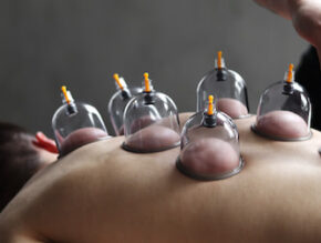 Focus Back Massage and Cupping